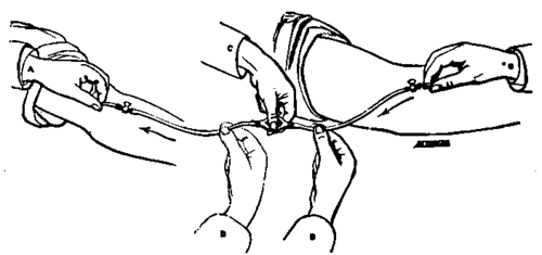 Fig. 317. Blood Transfusion