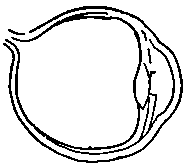 Fig. 452. Eye Ball of Short-sighted Eye.