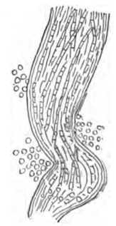 Fig. 345. A Hair affected by Ringworm.