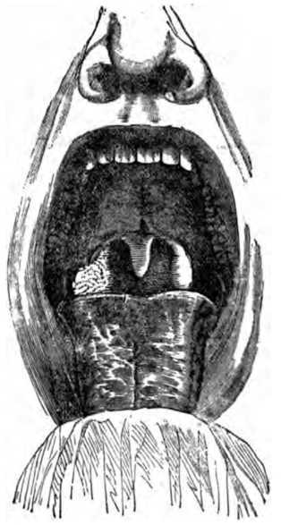 Fig. 337. Picture of Mouth.