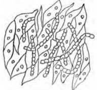 Fig. 344.-Ringworm Parasite, greatly magnified.