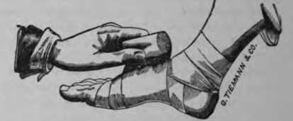 Fig. 365. Roller Bandage on Foot.