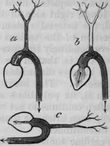Fig. 118.   Diagram to illustrate the tendency to syncope in aortic regurgitation. In a the aortic valves are healthy and prevent regurgitation. The carotid and its branches are shown as full.