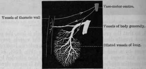 Fig. 122.   Diagram to show congestion of the lung. The pulmonary vessels are shown dilated, and those of the thoracic wall contracted.