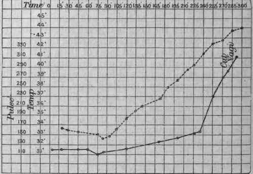 Fig. 215.   Shows the effect of rise of temperature after injection of digitalis. At the 45th minute .75 c.c. (12 minims) tincture of digitalis were injected, and another similar injection was made at the 55th minute.
