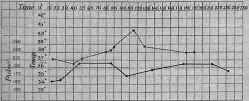 Fig. 216.   Shows the action of digitalis when given after the temperature has already risen. At the 30th minute the warming was begun; at the 100th minute .