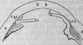 Fig. 75. This diagram (which I owe to the kindness of Mr. J. Tweedy) represents a section through the corneo scleral region, ciliary body and iris, of a healthy eye (left side), and of a glaucomatous eye (right side) : k, cornea; s, sclerotica; i, iris; /, spaces of Fontana; c s, canal of Schlemm.