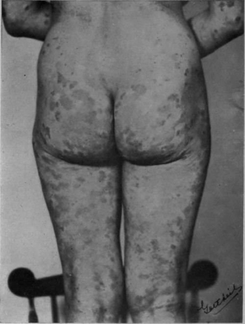 Fig. 59.