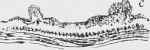 Ulcer with infiltrated walls