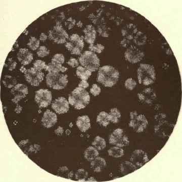 Butterine X 40 Animal Fats, Magnified.