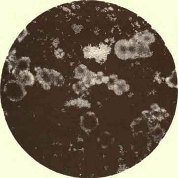 Oleomargarine x 40 Animal Fats, Magnified.