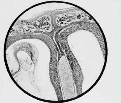 From a vertical section of the Cranium of a Rat set. three months, fed on ox flesh.