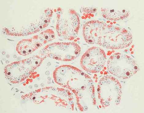 Kidney of rat fed on an ox flesh diet.