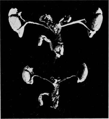 Male Reproductive Organs of full grown Rats from the same litter.