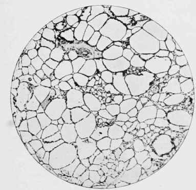 Thyroid Gland from normal Fowl.