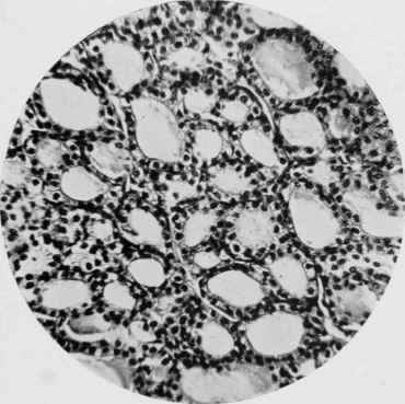 Thyroid Gland of Wild Rat.