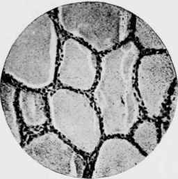 Thyroid Gland of Wild Rat (caught in a hotel basement) which was killed on receipt.