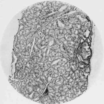 Thyroid Gland of Wild Rut.
