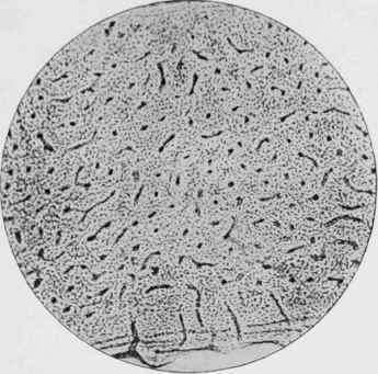 Transverse section of the normal bone seen in Fig. 5, for comparison with Fig. 7.
