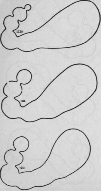 3 Activity Of The Cardiac Portion Of The Stomach 11