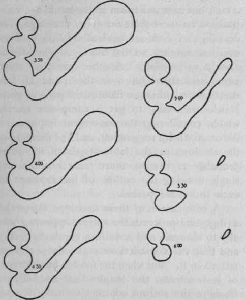 Figures 2, 3, 4, and 5 present outlines of the shadow of the contents of the stomach.