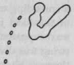 Tracing showing seg mentation of chyme in the duo denum .