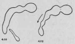 Tracings showing changes when food enters the colon and also the first tonic constriction.