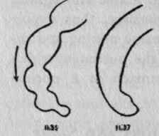 Tracings showing the effect of excitement on antiperistalsis in the colon.
