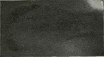 Two radiographs and a tracing showing the changes taking place in defecation.