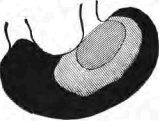 Section of frozen stomach of rat during digestion.