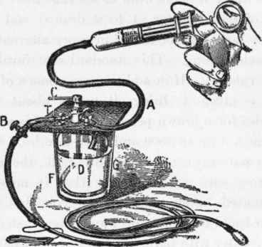 The duodenal feeding apparatus, with table support.