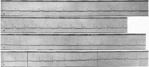 Electrocardiograms for Kon and Pec. A, B, and C, from L1 L2, and L3 for Kon in group chamber.