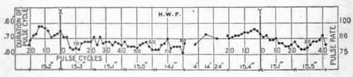 Transition Pulse Of A Group Of Normal Men 125