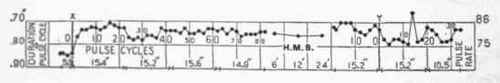 Transition Pulse Of A Group Of Normal Men 126
