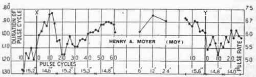 Transition pulse curves for Gullickson, Montague, and Mover, Squad A, February 3, 1918.