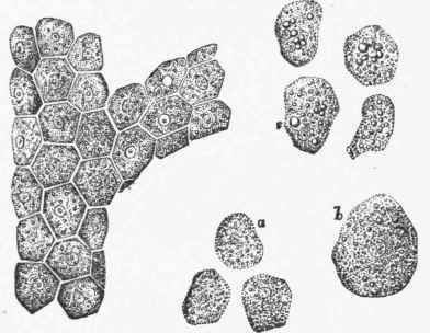 Cells of the Liver. One large mass shows the shape they assume by mutual pressure..