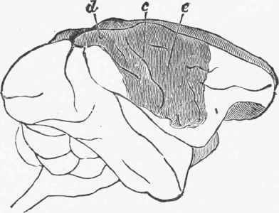 Dark shading indicates the extent of a lesion of the gray matter of the right hemisphere of a monkey.