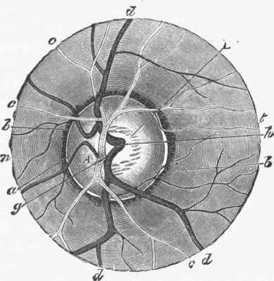 Ophthalmoscopic view of fundus of eye, in which the central artery.