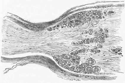 Section through spinal ganglion of a cat, showing ganglion cells interspersed between the fibres.
