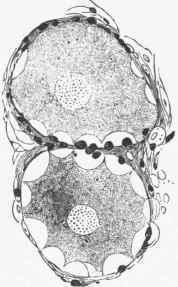Two cells from the former seen under a high power, showing the fine protoplasm here and there retracted from the cell wall.