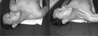 Side Head Posture 56