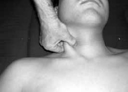 The Muscles At The Front Of The Neck 73