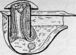 Water Seal Traps 106