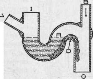 Fig. 210. Foreign Matter (Lint. Strings.