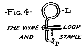 the wire and loop staple
