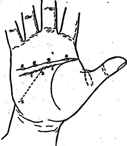 Plate IV. Islands On The Line Of Head.