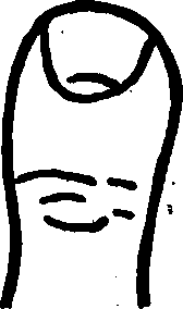 The Elementary Thumb.