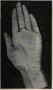 ALL FINGERS CLOSE TOGETHER