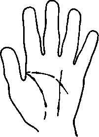 Character Of The Lines Defects And Repair Individu 158