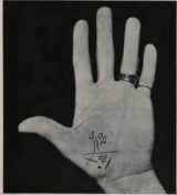 Distinguishing marks on the mount of venus